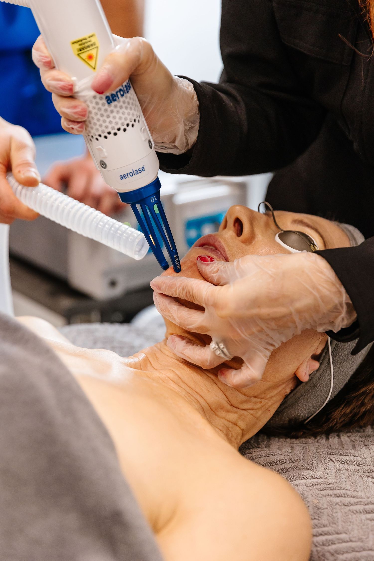 Medical professional performing a cosmetic treatment using a specialized device on a patient lying on treatment table.