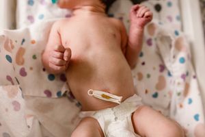 Details-of-umbilical-cord-on-a-newborn-baby-boy-born-at-St.Francis-hospital-in-Tulsa,OK