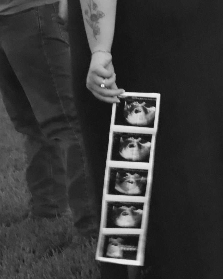 Black and white close-up of hands holding ultrasound photo strips.