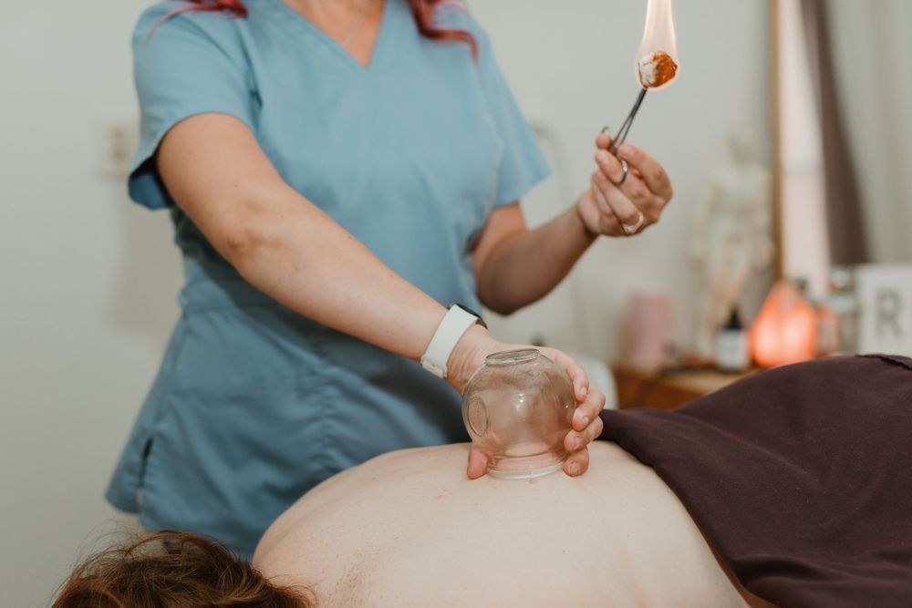 Close up of cupping therapy treatment being performed on patient's back.