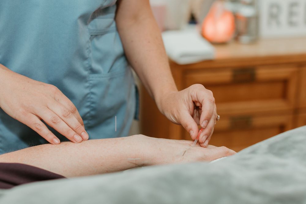 Healthcare provider performing acupuncture treatment on patient.