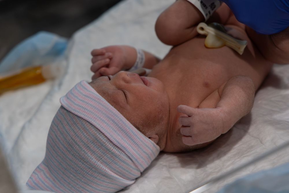 Newborn baby lying on a hospital blanket shortly after birth, with medical monitoring equipment attached.
