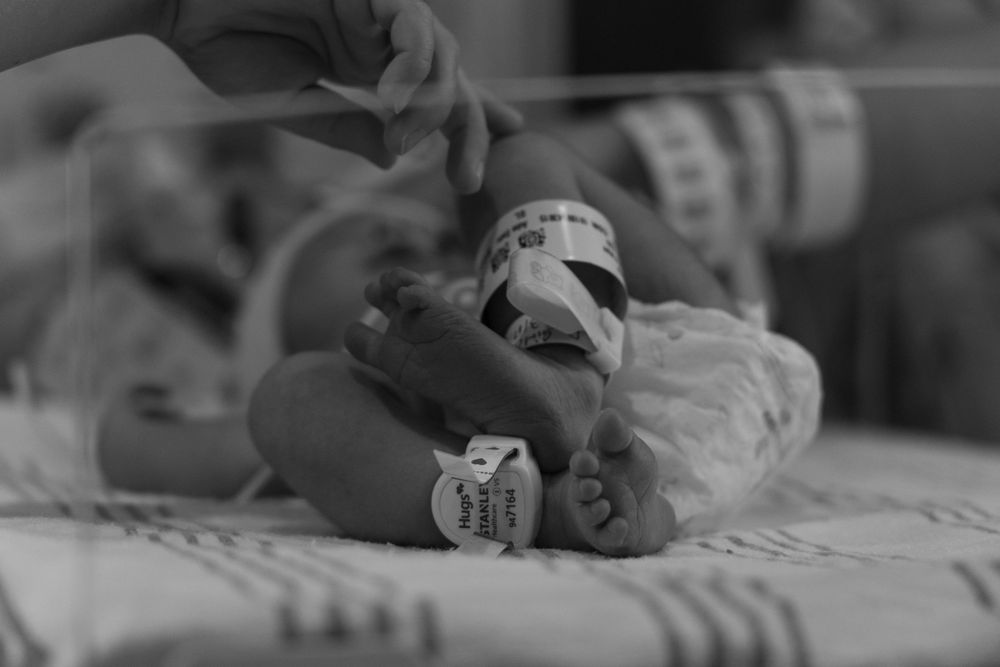 Black and white photo of a premature newborn baby in a NICU incubator with hospital ID bands on tiny wrists.