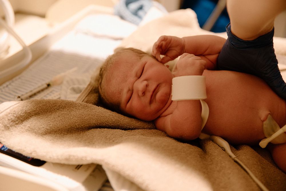 Newborn resting on a beige blanket while being monitored in a medical setting.