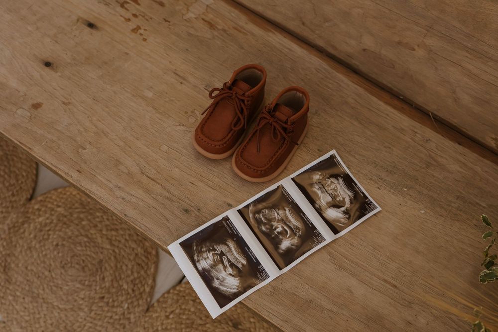 Ultrasound photos arranged on a rustic wooden floor surface.