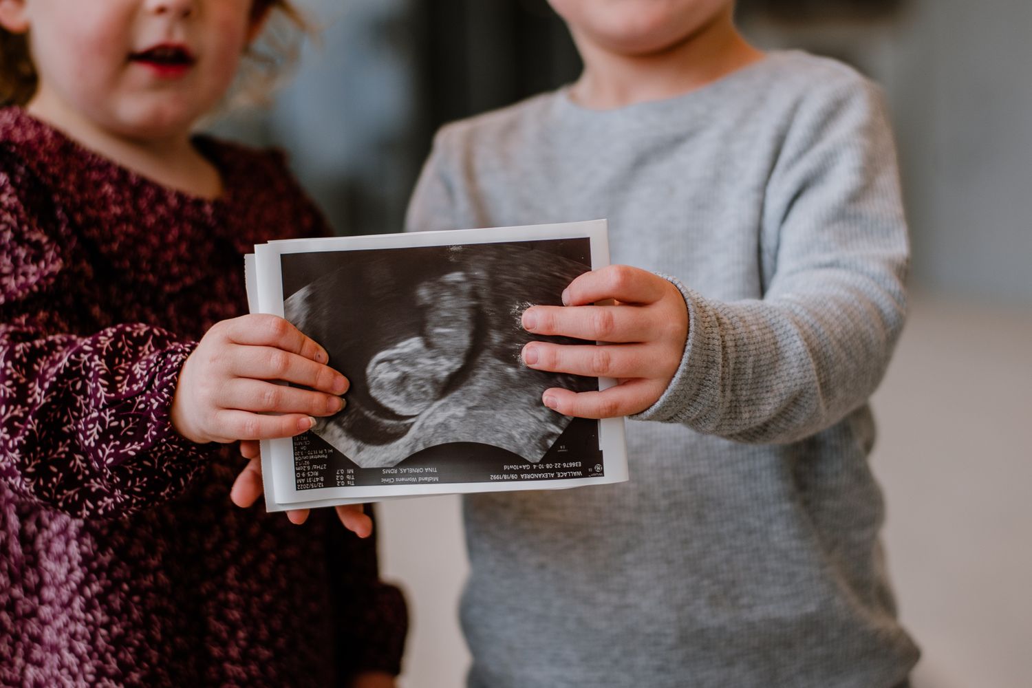 Small children holding and looking at an ultrasound photo together.