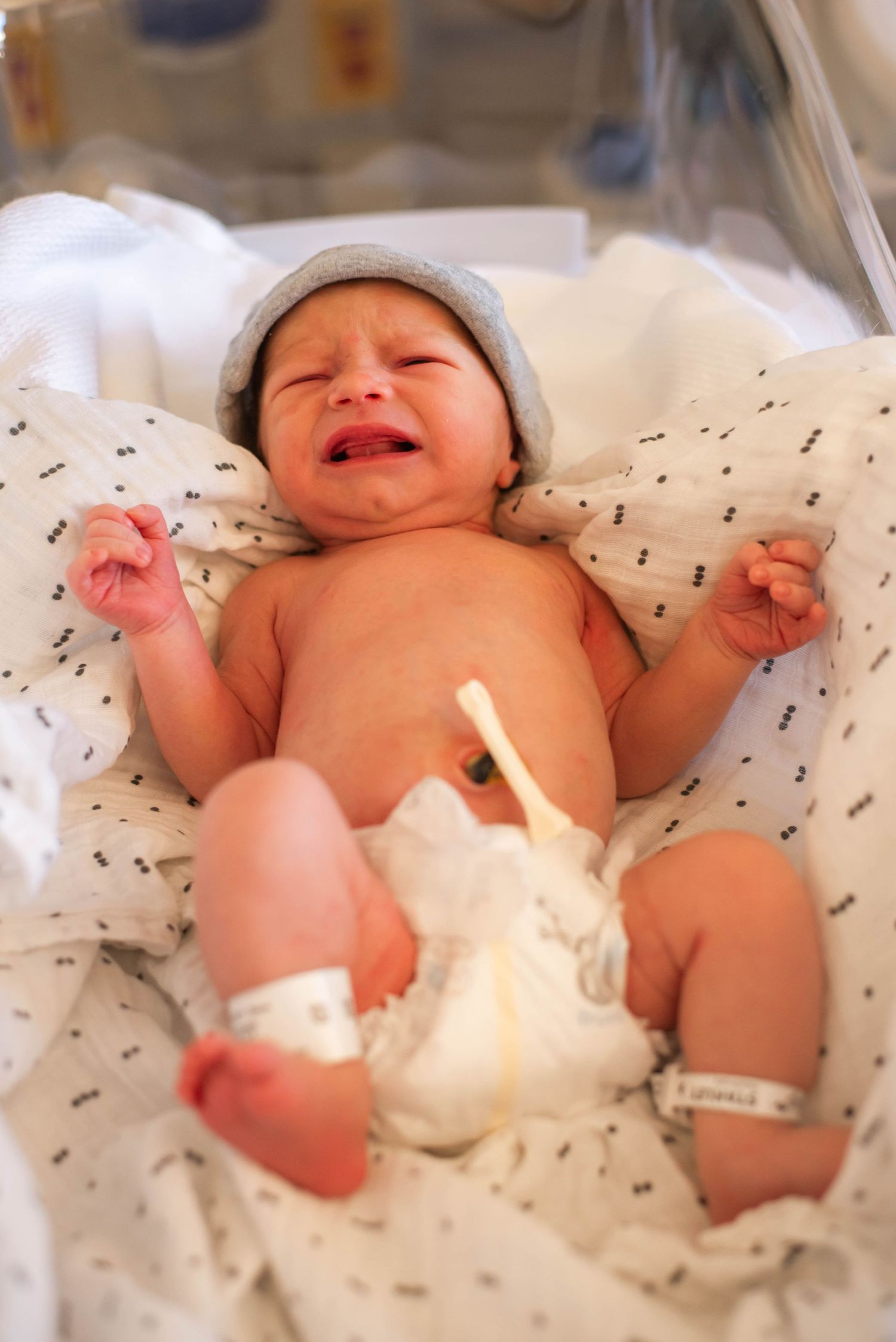 Crying newborn baby lying in hospital bassinet wearing blue hat with umbilical cord clamp visible.