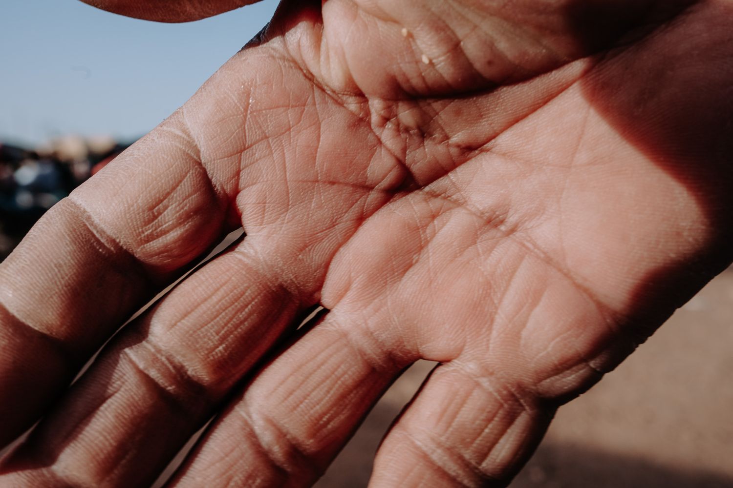 Close-up of an open human palm showing detailed skin texture, lines, and fingers against a warm sunlit background.