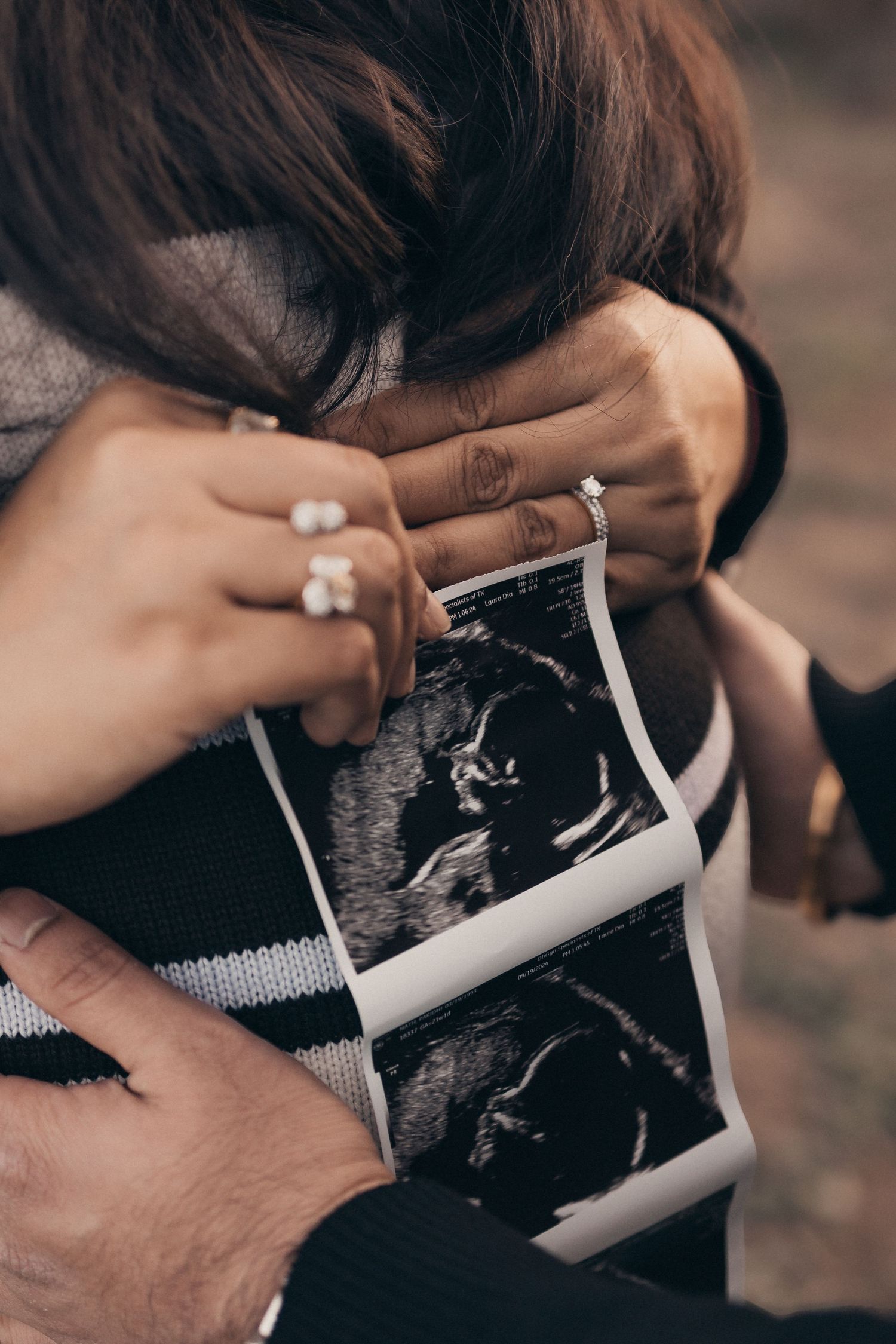 Hands holding ultrasound images in black and white close-up shot.