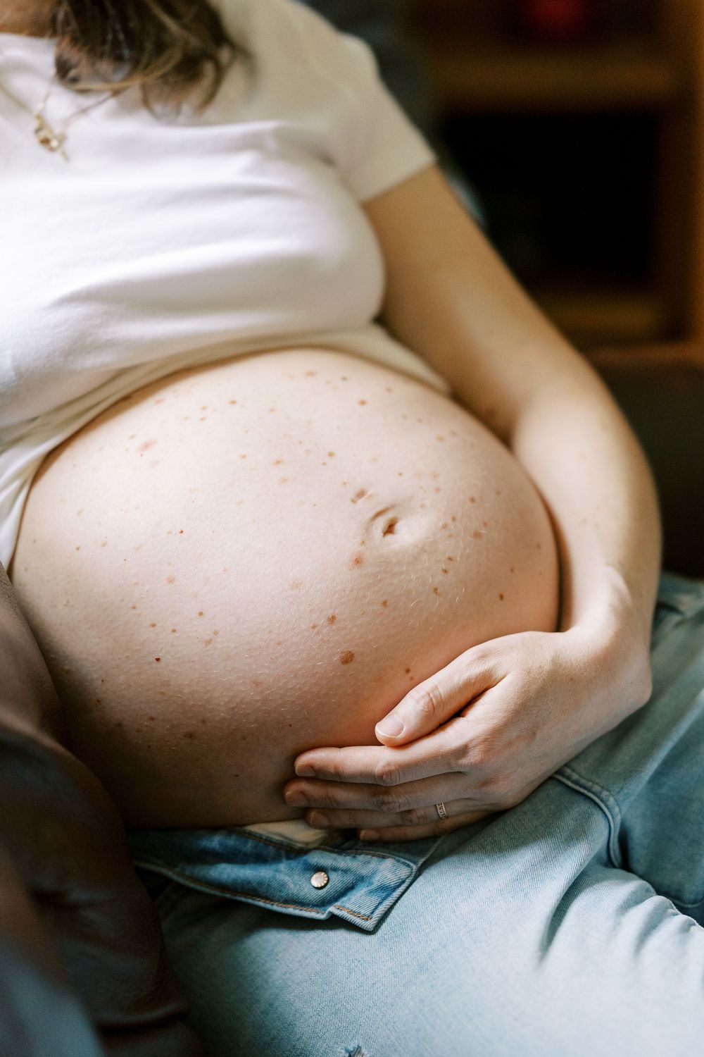 Close up of pregnant belly with stretched skin and stretch marks in natural window light in Clifton, New Jersey.