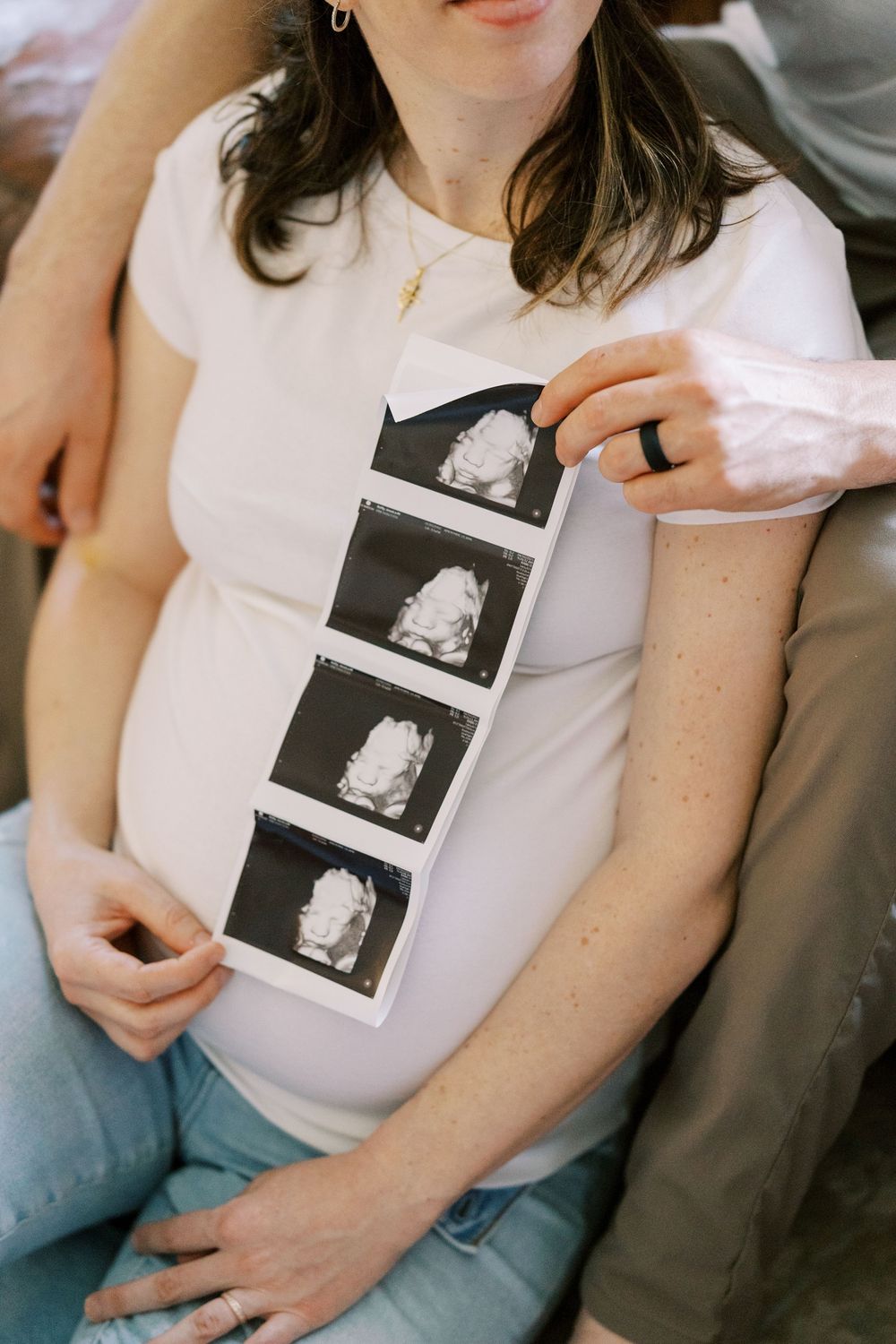 A person holds a strip of ultrasound photos showing a developing baby in Clifton, New Jersey.