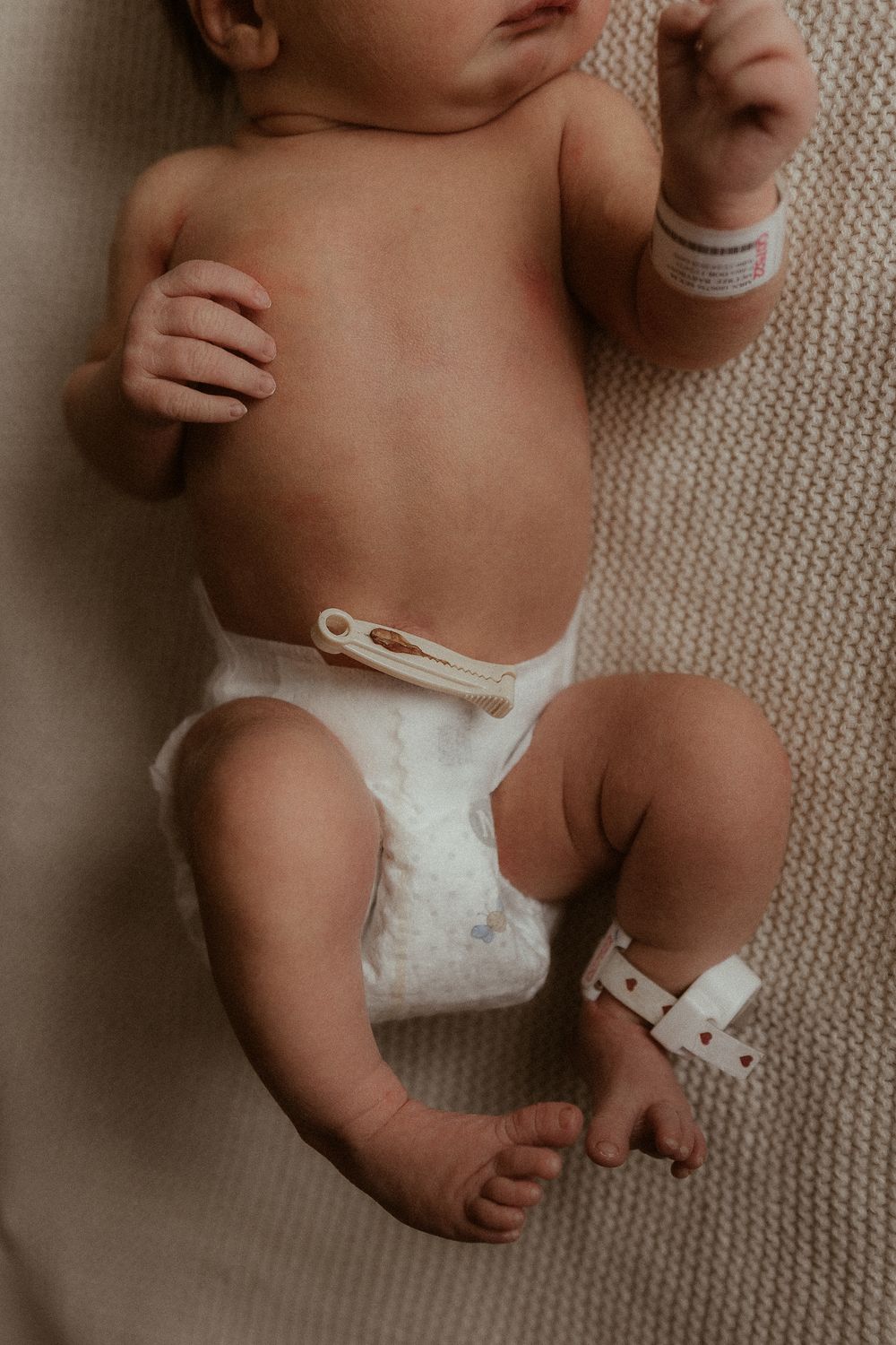 A baby wearing a white diaper lies on a beige carpet in a series of cropped shots showing different angles.