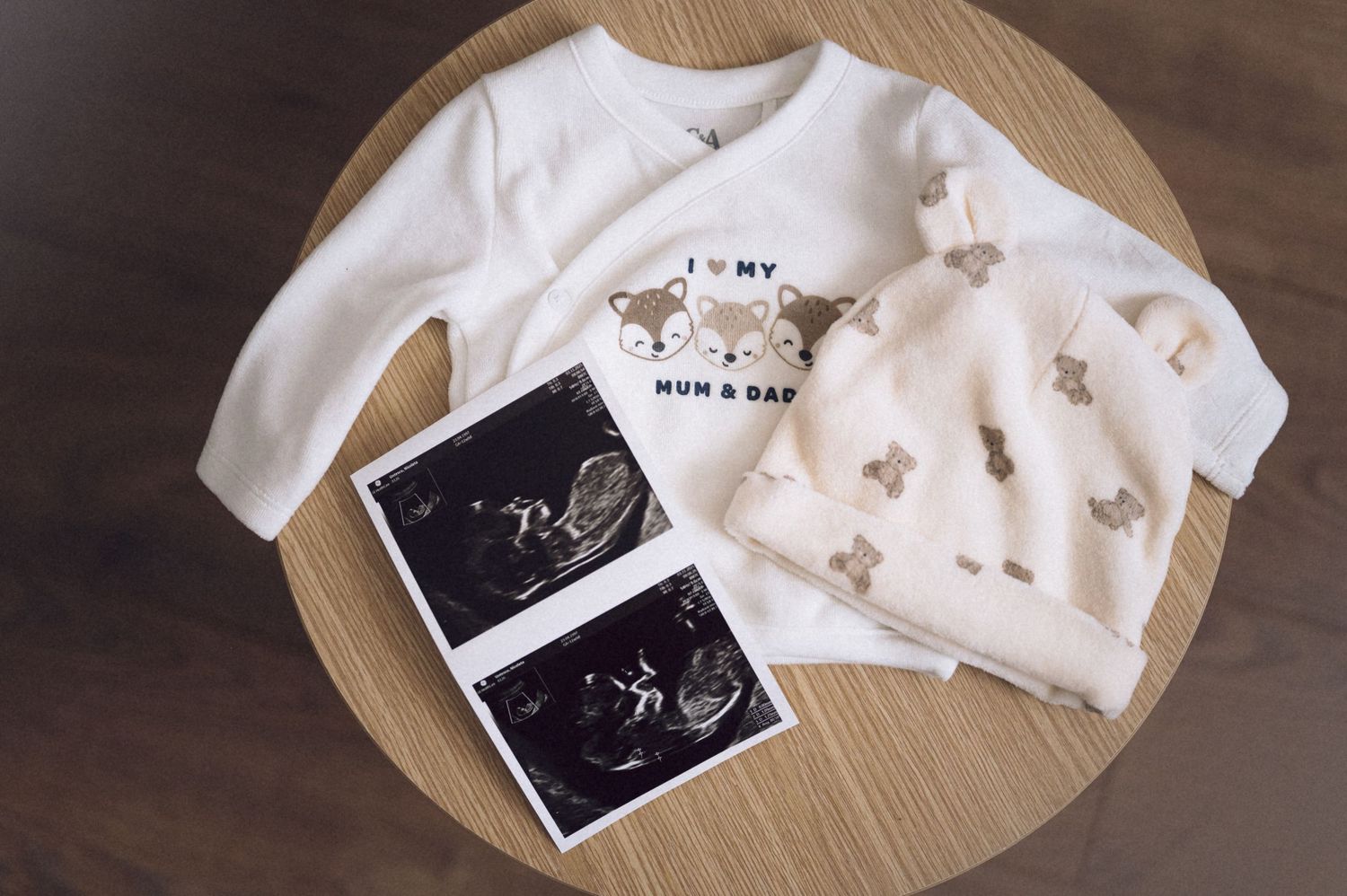 Collection of ultrasound photos and baby clothes arranged on wooden surface in pregnancy announcement style.