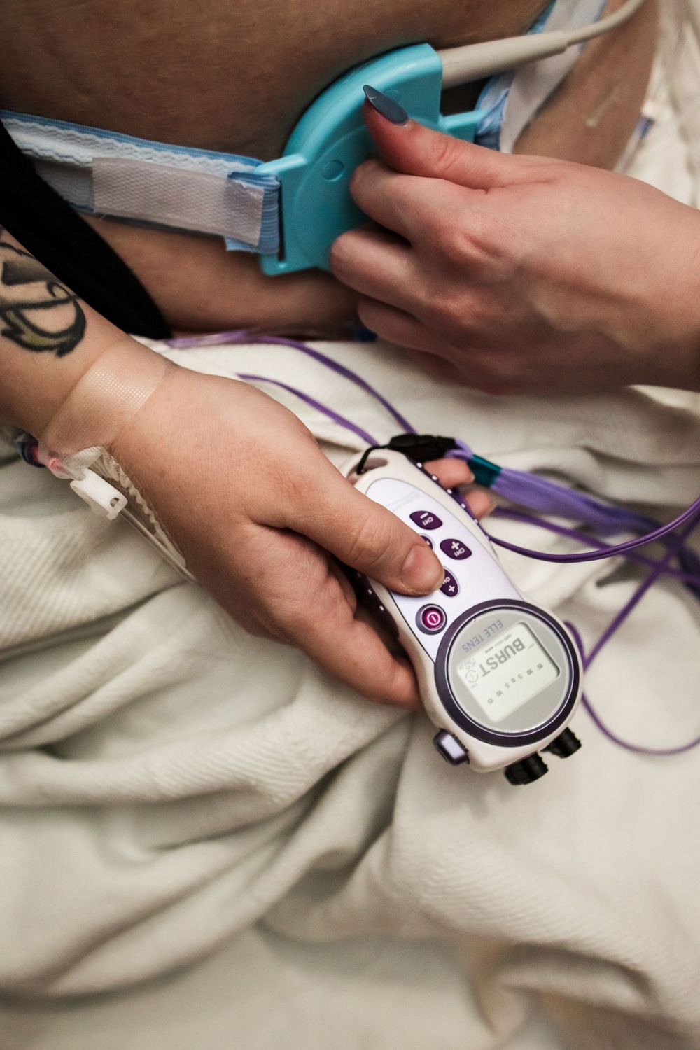 Close-up of medical monitoring device with purple and white cords on hospital bedding.