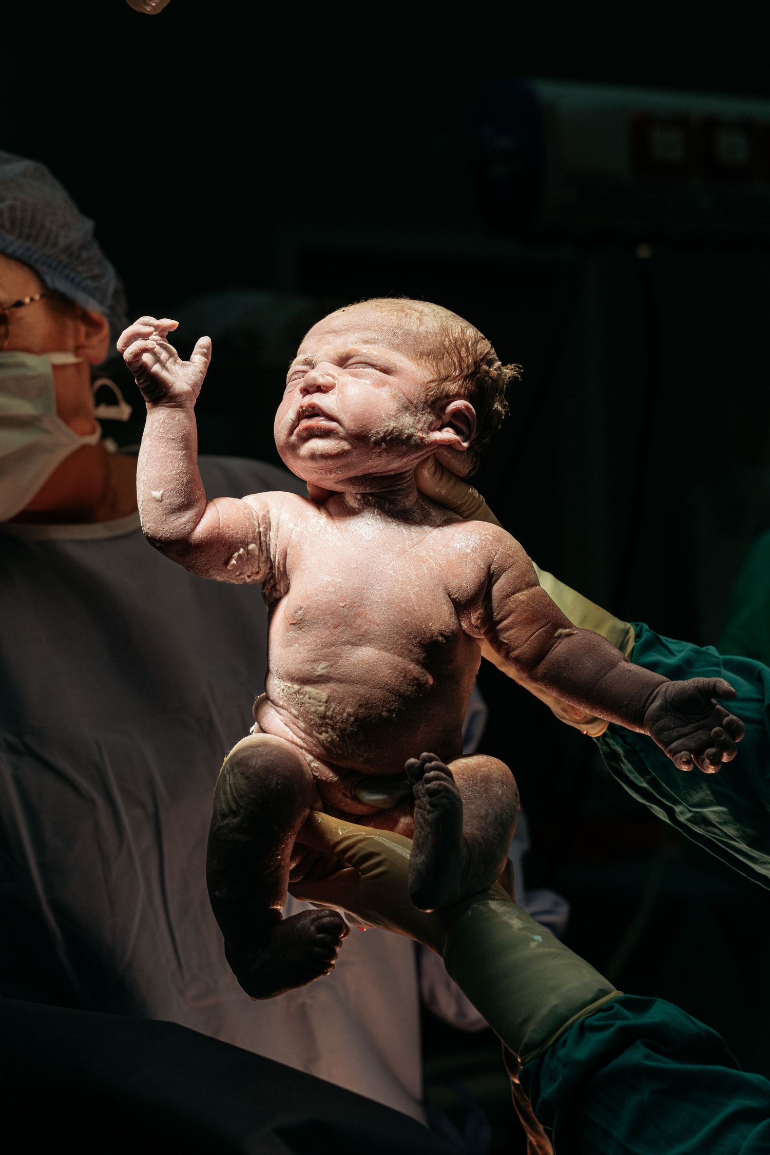 Newborn baby held by medical staff immediately after delivery in an operating room.