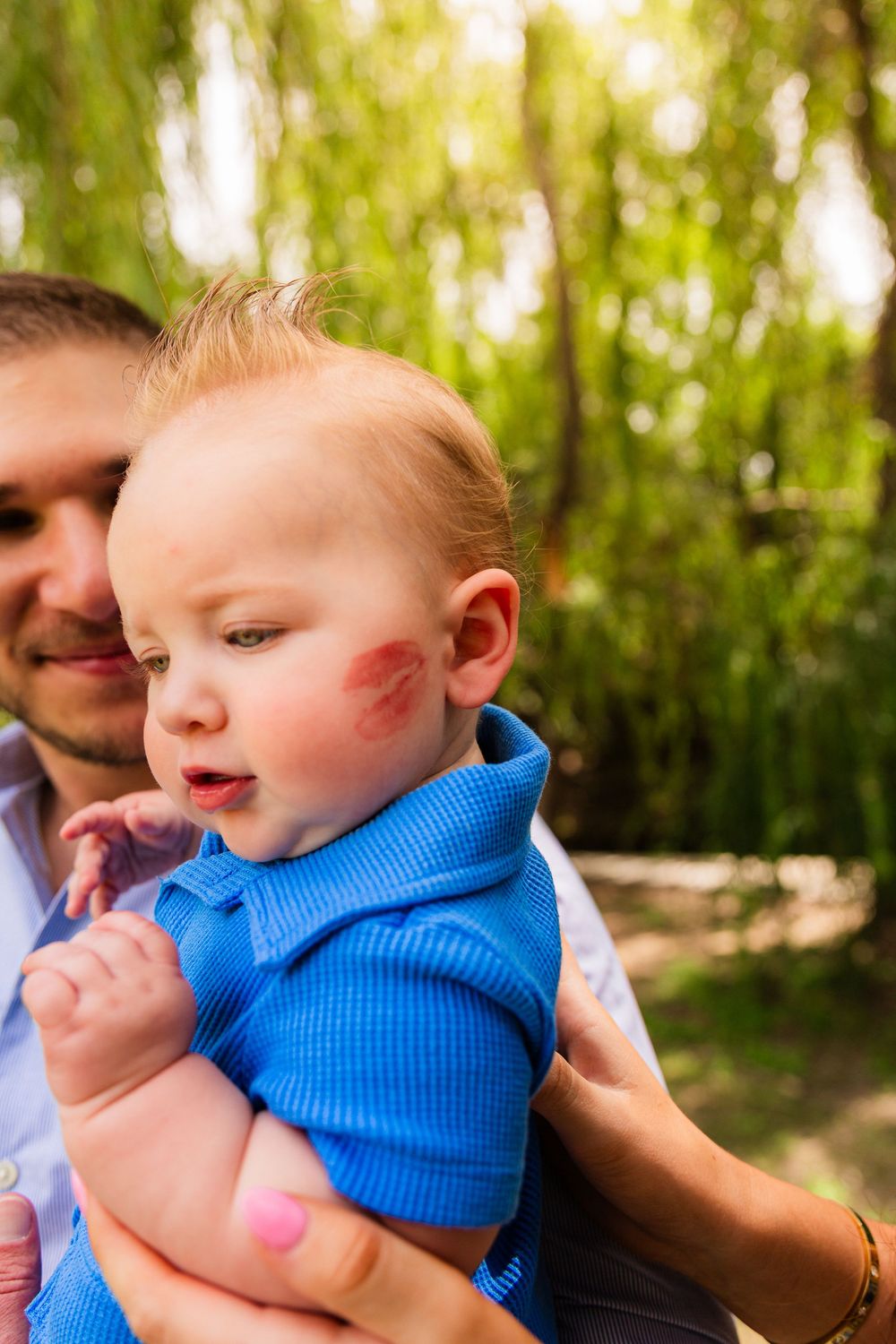 Father holding baby with red birthmark on cheek, dressed in blue, outdoors with green trees background.