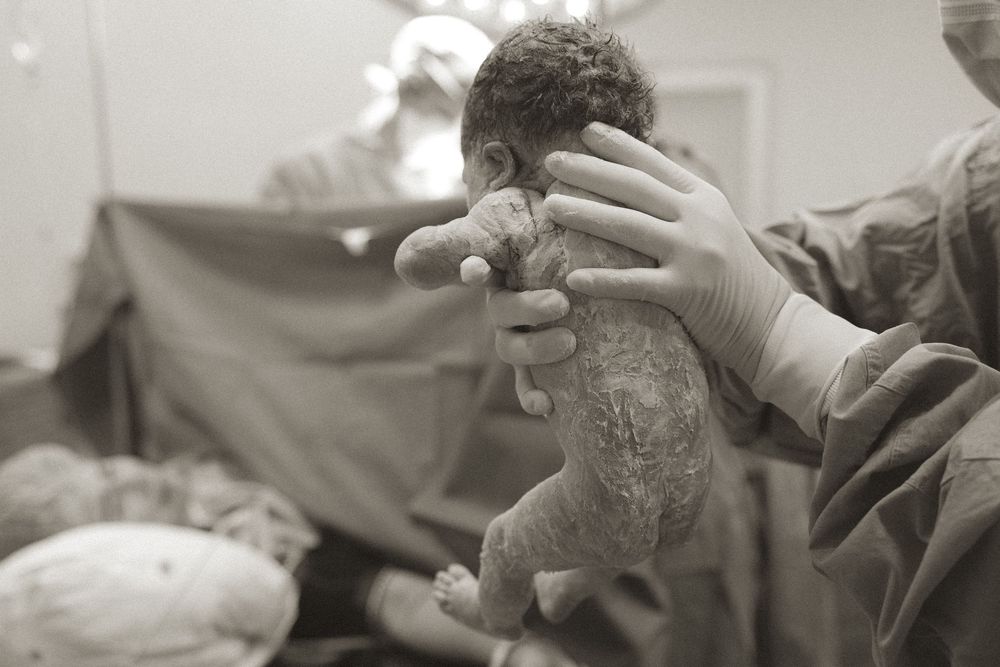 A series of black and white medical photos showing hands performing dental procedures on a patient.