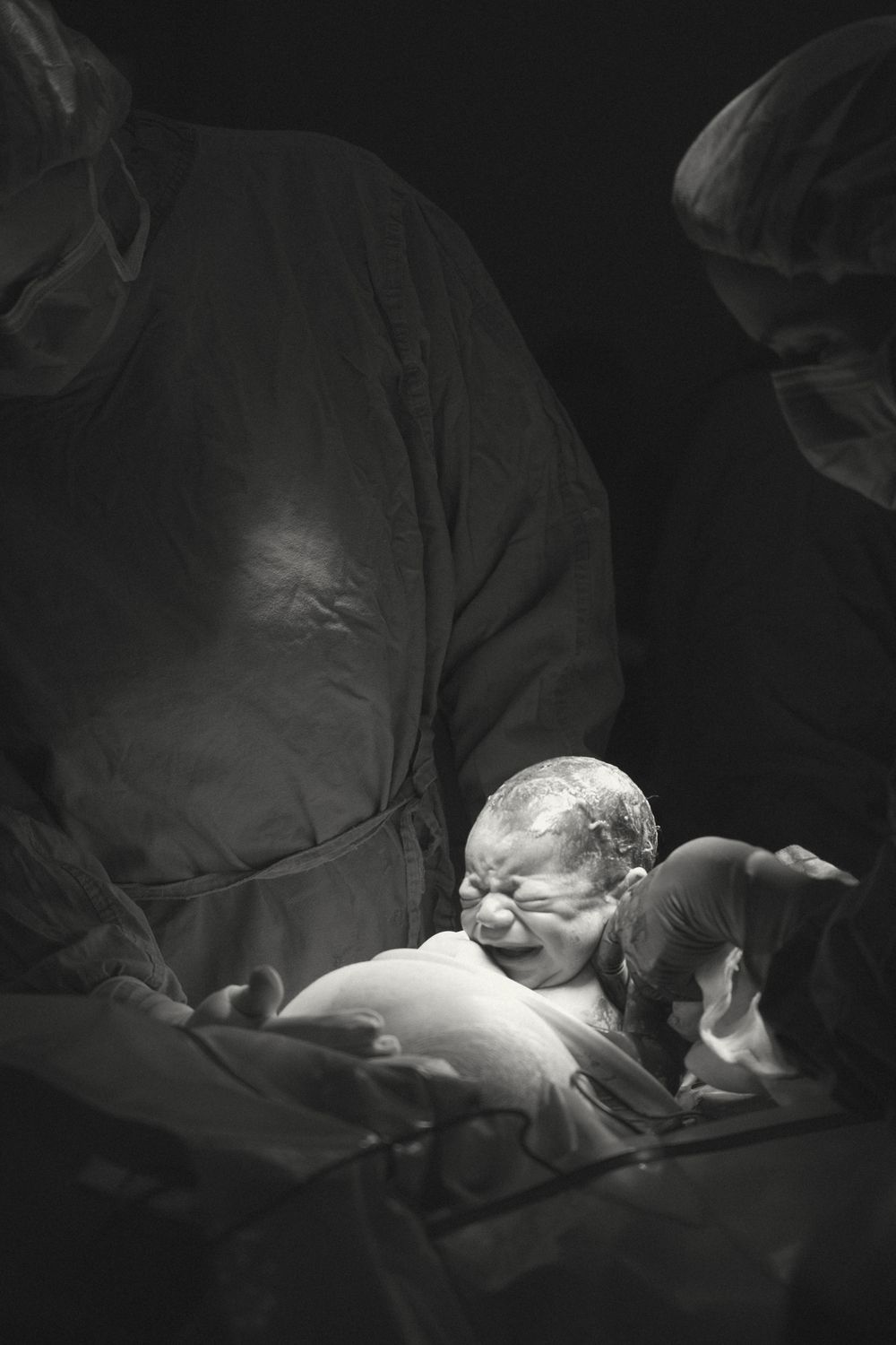 Medical team performs surgery in dark operating room with focused lighting illuminating the surgical field.