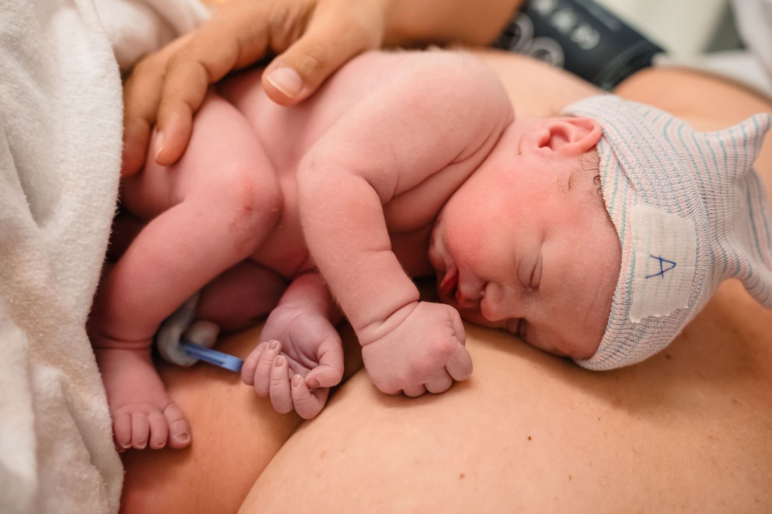 Hier zie je een foto van een kindje dat na de keizersnede lekker bij mama op de borst ligt.