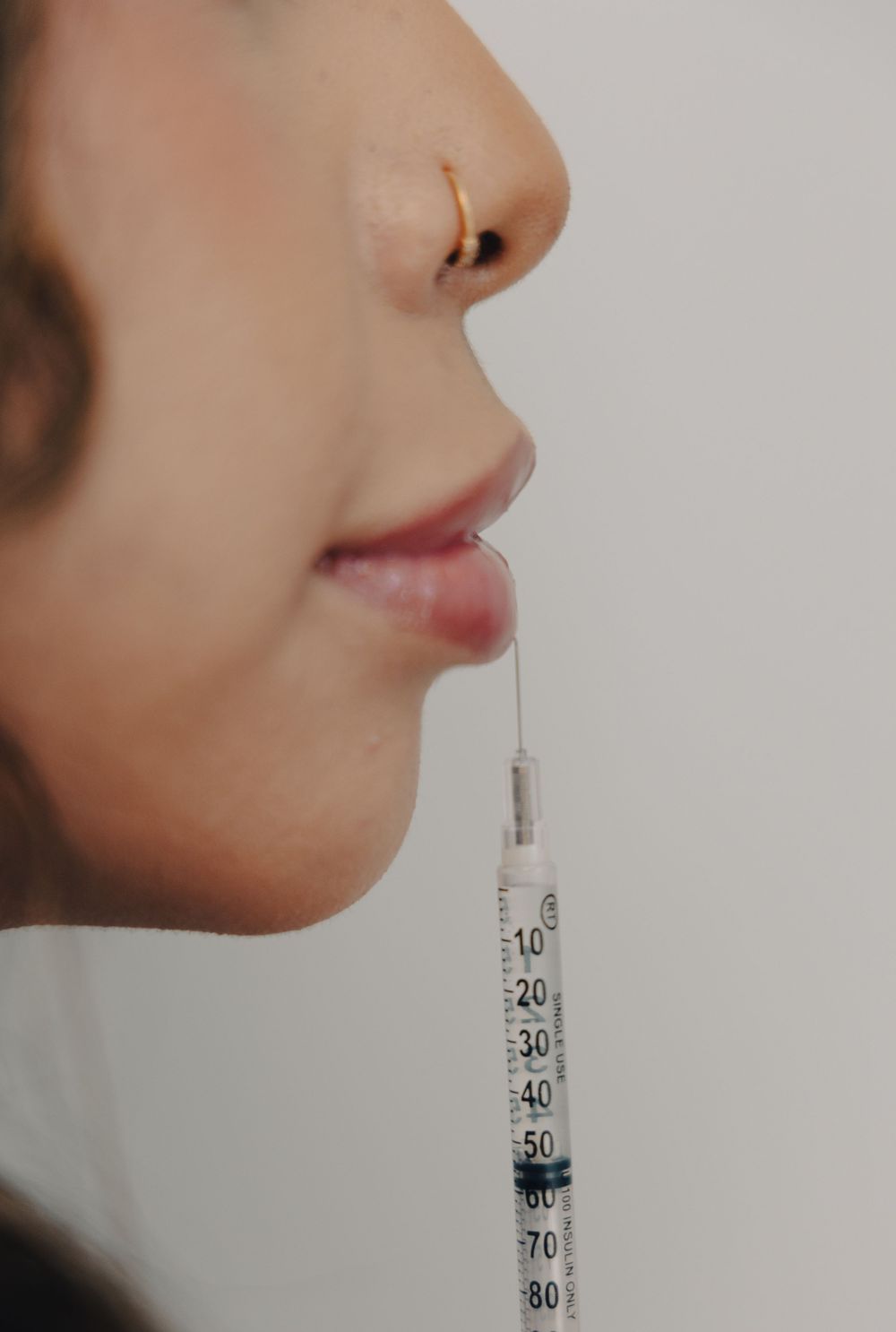 Close-up of lip filler injection with syringe on woman with nose ring.