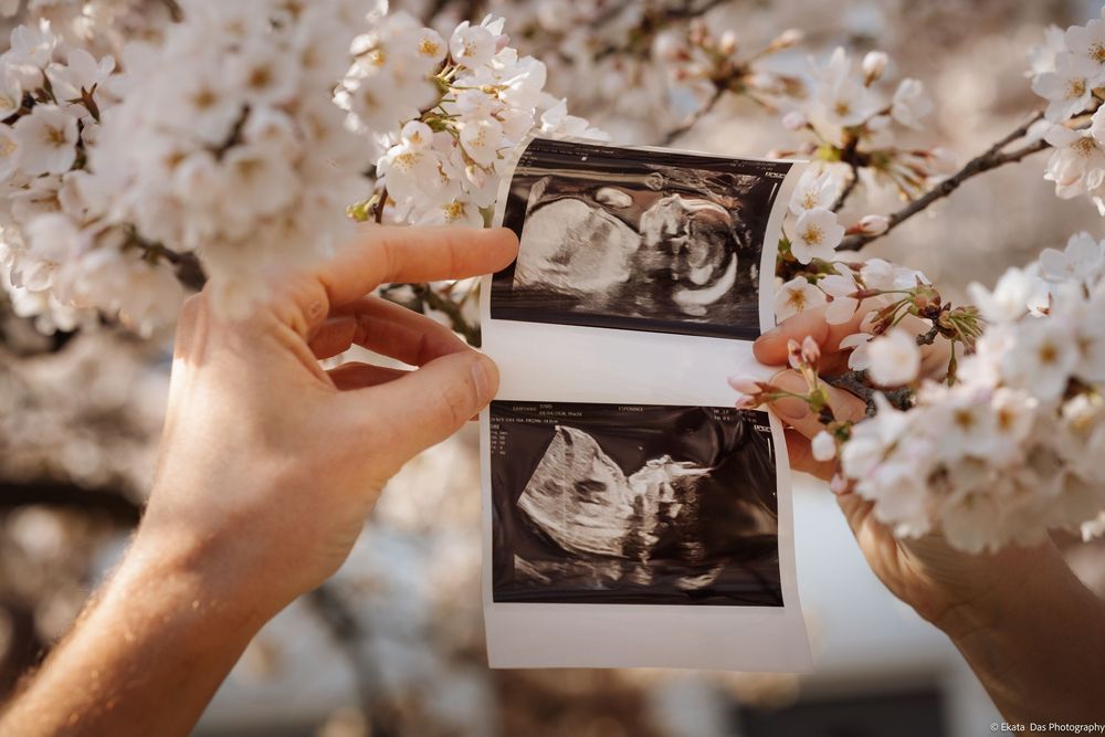 Hands holding ultrasound photos among delicate cherry blossoms in soft sunlight.