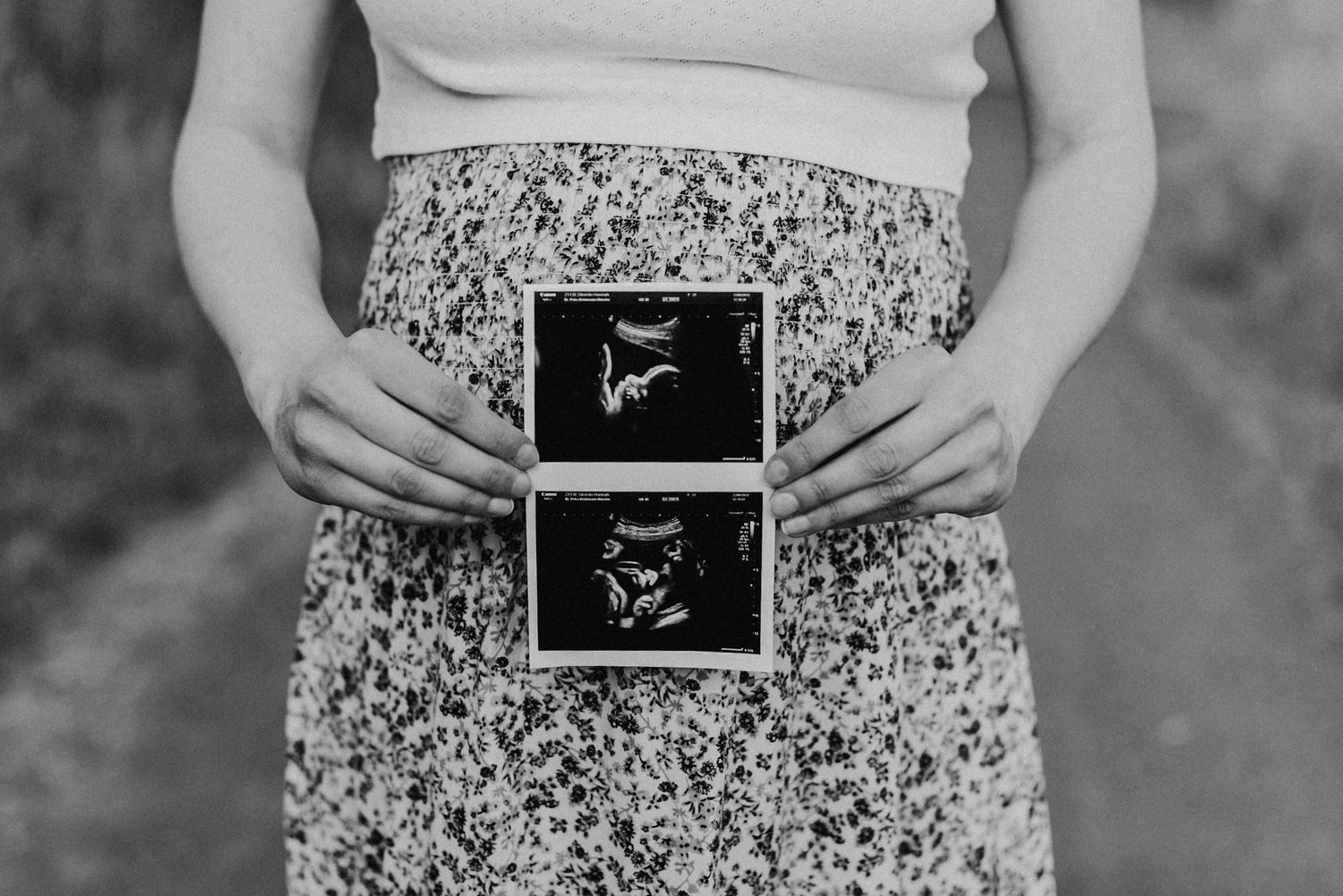Schwangere Frau in geblümtem Kleid hält Ultraschallbilder vor ihrem Bauch. Schwarz-weiß-Foto auf einem Weg im Freien.