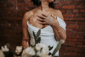 Bride in white off-shoulder gown with vitiligo skin posing against brick wall.