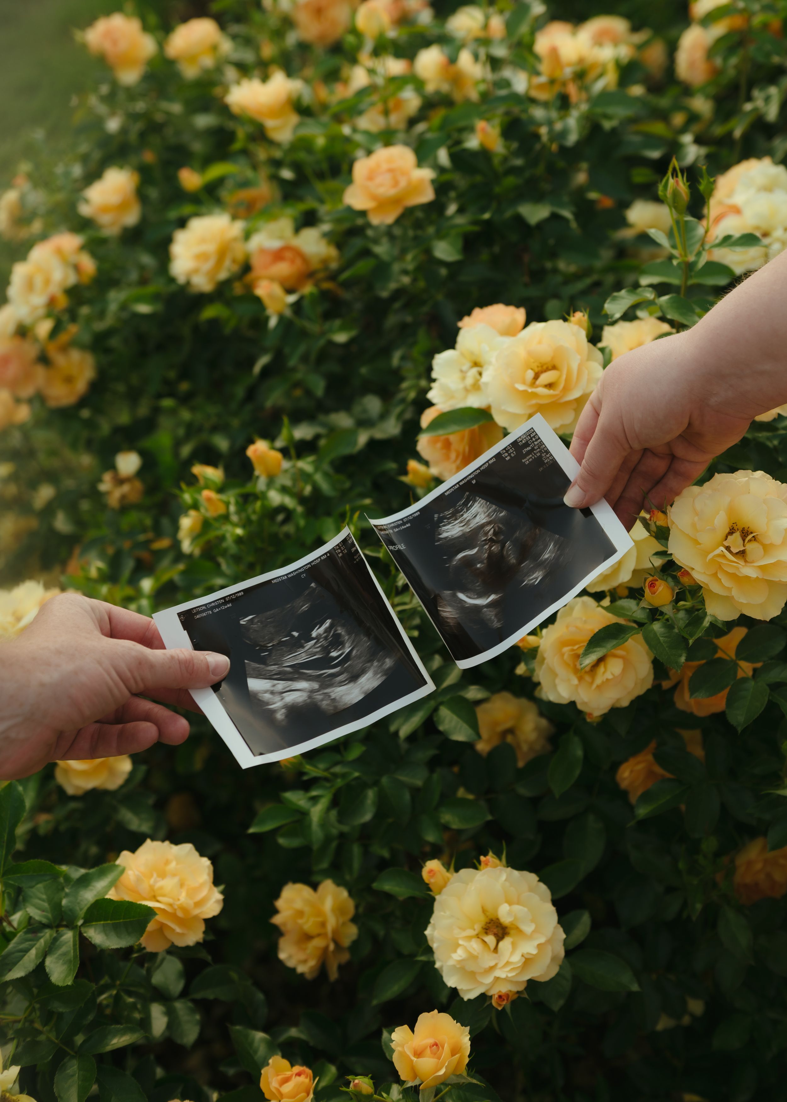 Two hands hold ultrasound photos in front of blooming yellow roses, announcing a pregnancy.