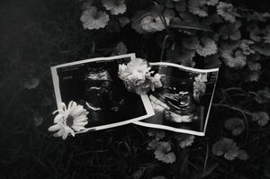 Black and white photo of ultrasound sonogram prints with white flowers on dark foliage background.