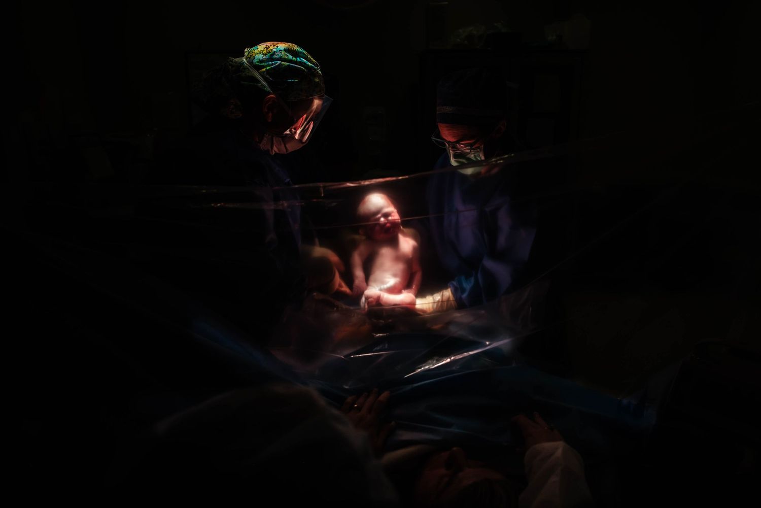 cesarean birth photography at northern light mercy hospital maine