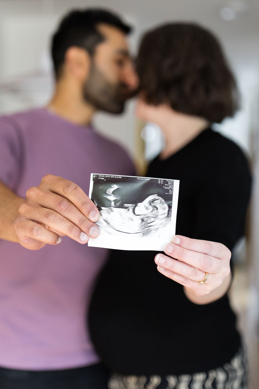 couple holding black and white ultrasonography photo of their baby