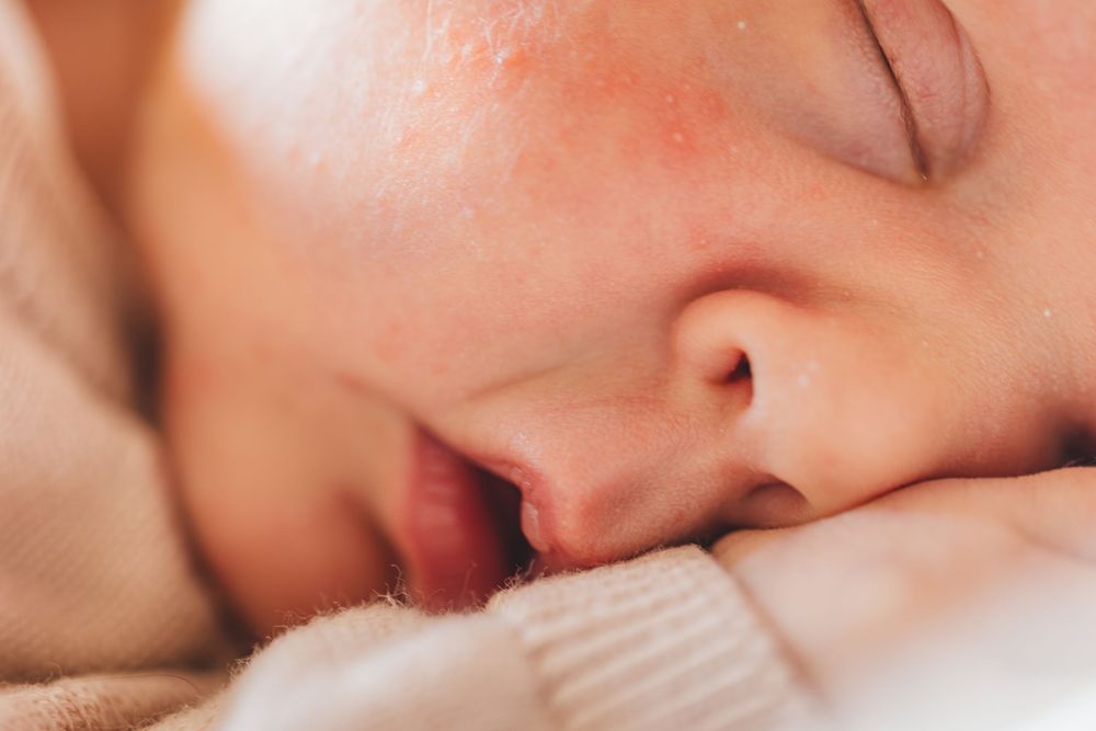 Close-up of a sleeping newborn baby face with soft skin and peaceful expression.
