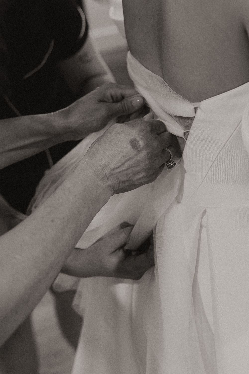 Close-up black and white photos showing hands adjusting a white collar or shirt in sequence.