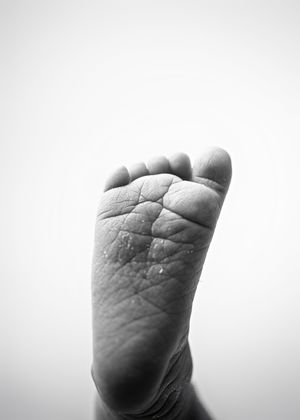 Black and white close-up photograph of a tiny baby foot showing delicate skin texture and wrinkles.
