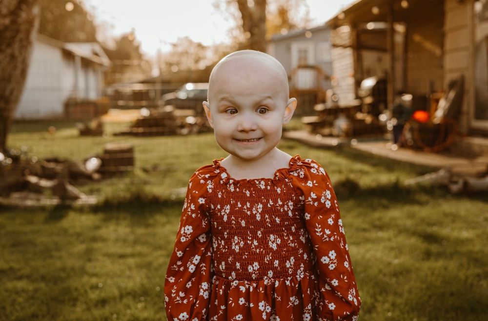 Smiling bald toddler girl in red floral dress standing outdoors in backyard during golden hour.