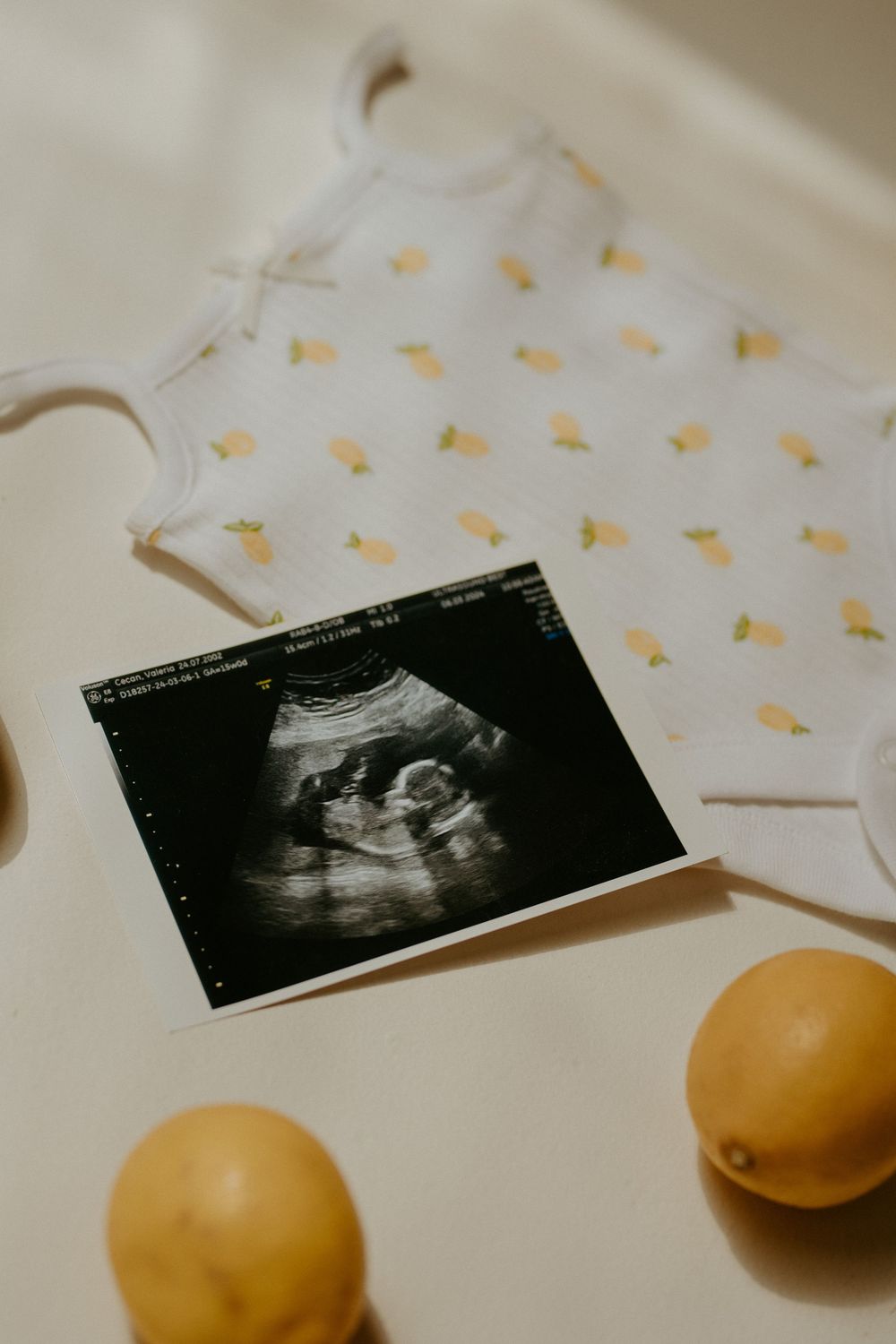 Ultrasound sonogram photo displayed next to oranges on a white surface with yellow butterfly decorations.