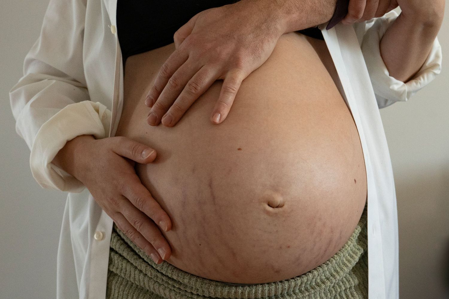 Close-up of a pregnant woman's bare baby bump showing stretch marks, with hands gently cradling the belly.