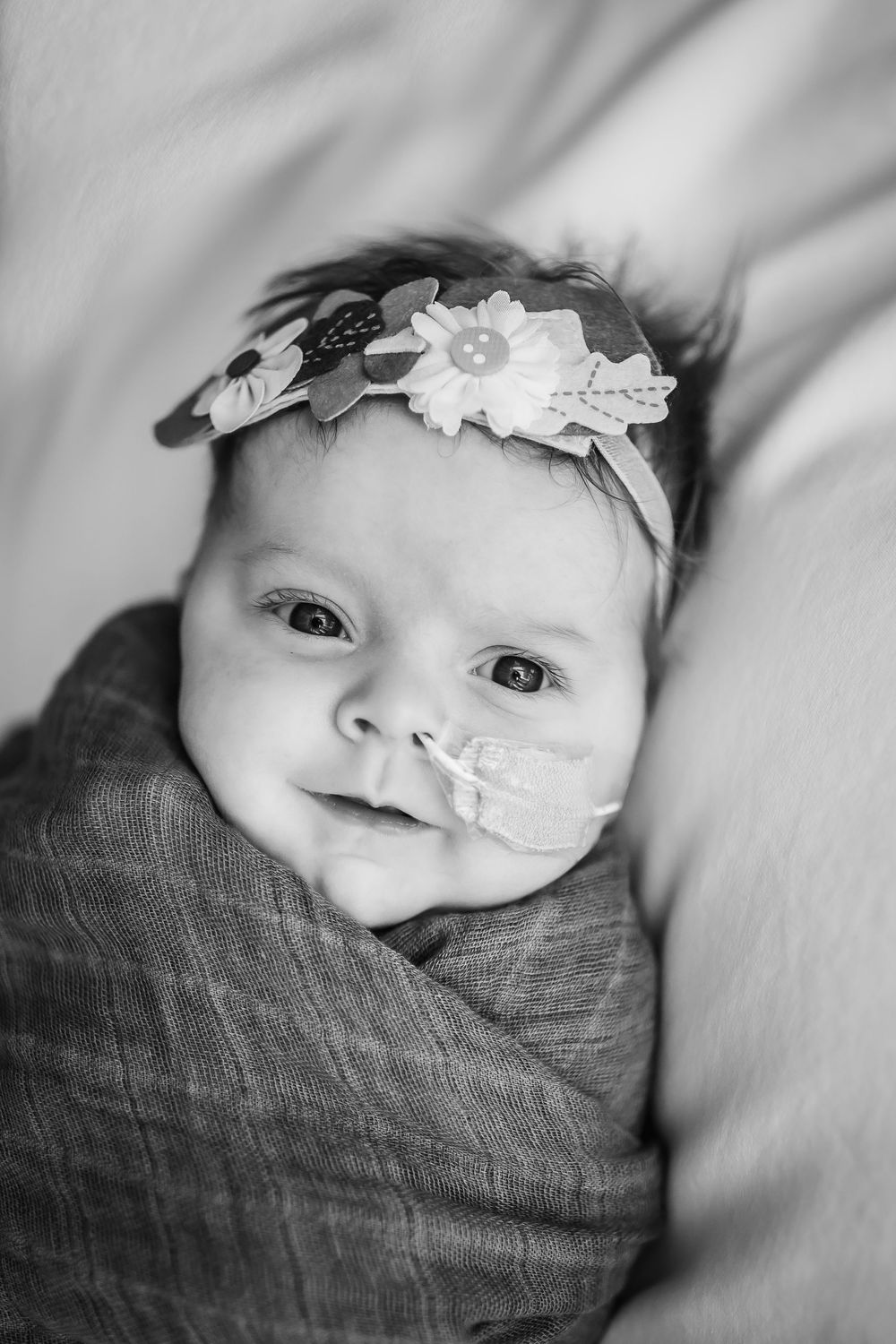 A newborn baby with feeding tube smiles warmly in a black and white portrait