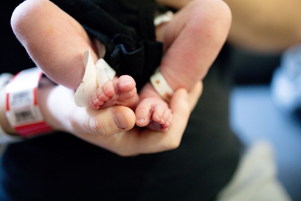 Close-up of a premature newborn baby's tiny feet resting in a parent's gentle hands with hospital ID bands.