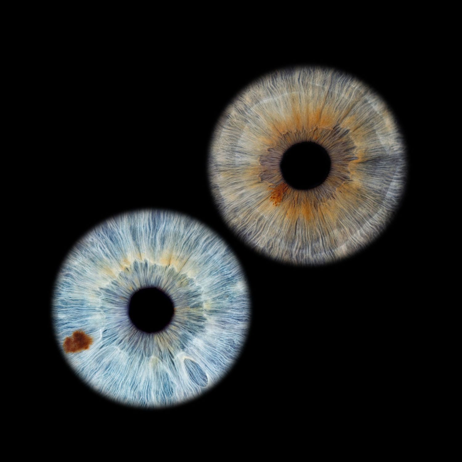 Close-up macro photography of two human irises, one blue and one amber, against a black background.