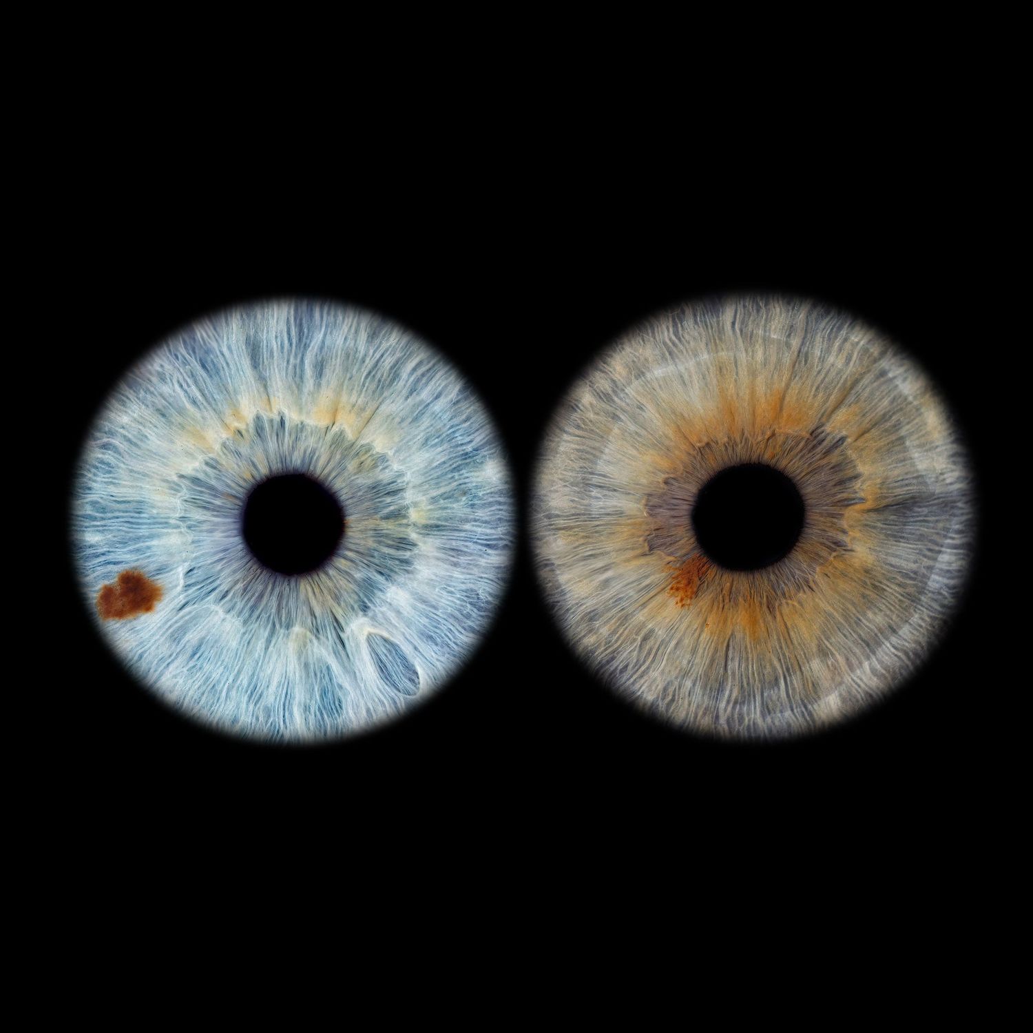 Two macro photographs of human irises side by side, one blue and one amber, against a black background.