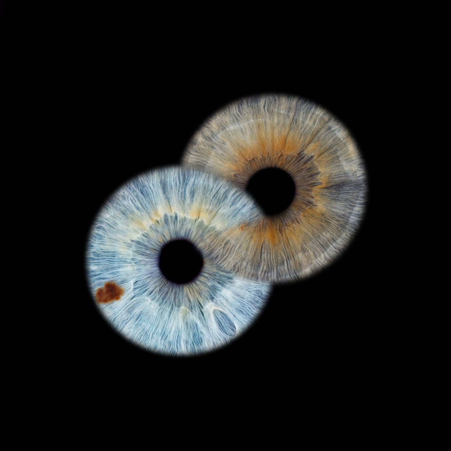 Two striking iris images overlapped with one blue and one brown showing intricate detail against a black background.
