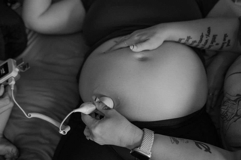 A close-up black and white photo of a pregnant belly with hands wearing hospital bracelets resting on it.
