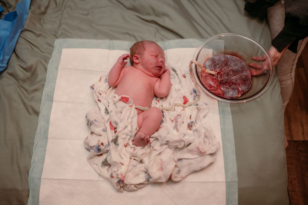 A newborn baby lies on a patterned white cloth next to medical instruments during birth assessment.