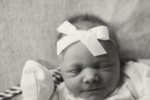 Black and white portrait of a sleeping newborn with medical tape.