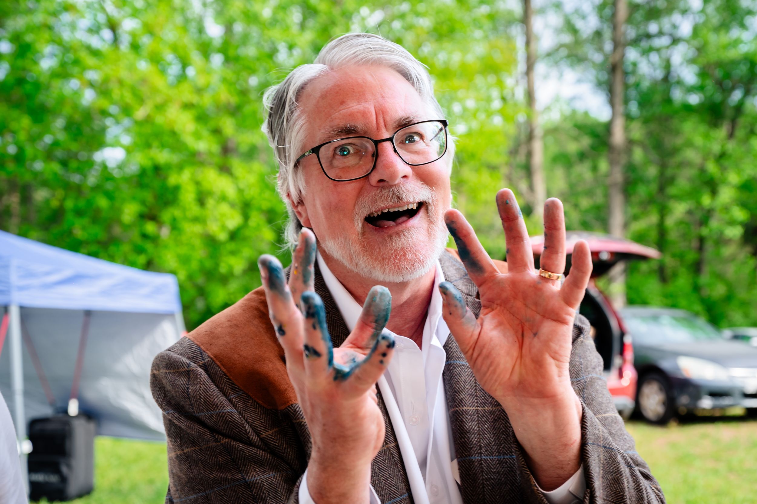 Surprised man with glasses showing dirty hands with long gray nails outdoors near trees and parked cars.