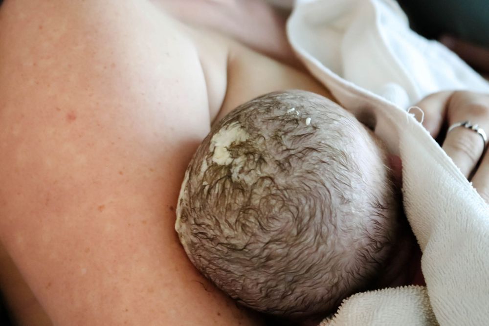 Close-up of a newborn baby's head covered in vernix resting on mother's chest after birth.