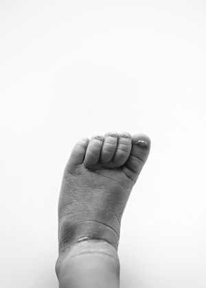 Black and white close-up photograph of an infant's tiny foot showing delicate wrinkles and toes against a white background.