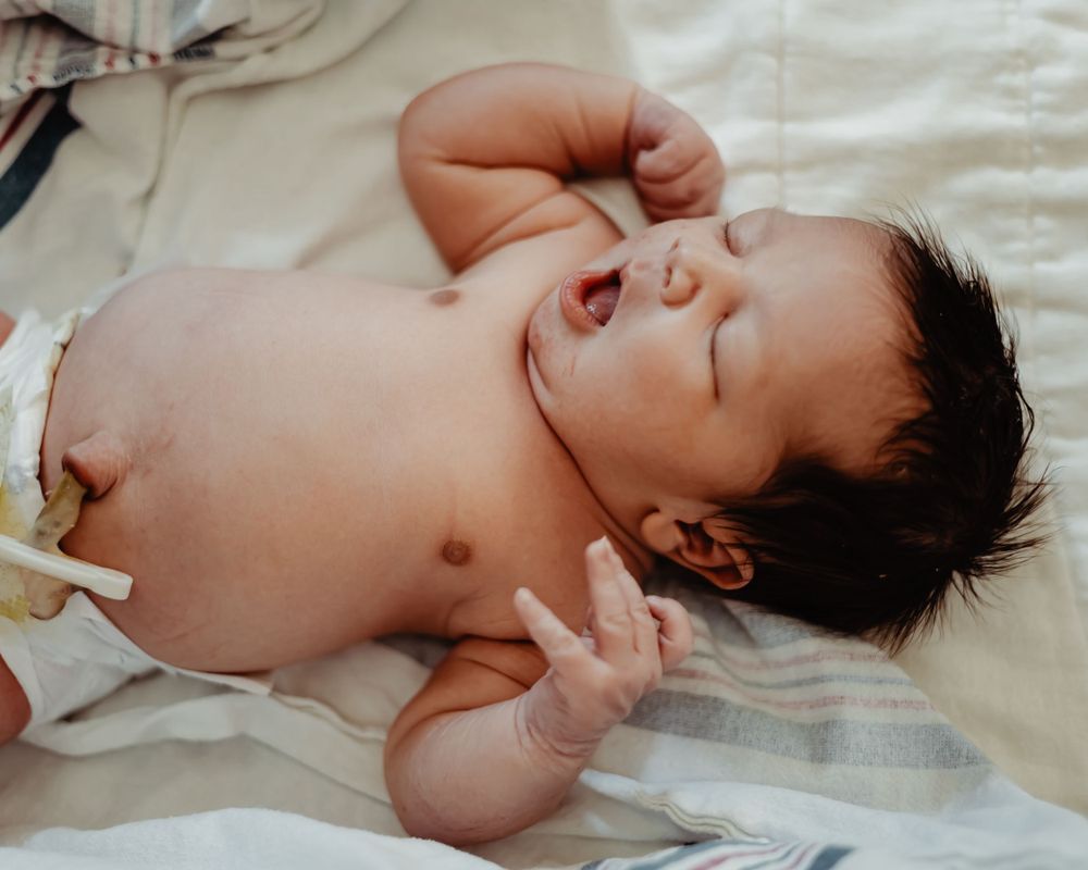 Newborn baby lying on white sheets with arms raised while sleeping.