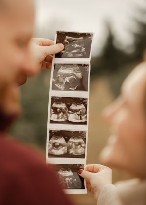 A strip of ultrasound images being held up showing different views of a developing baby.
